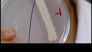 Lipase test (Lipid hydrolysis assay)